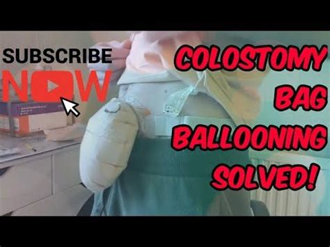 stoma bag ballooning|colostomy bag filled with gas.